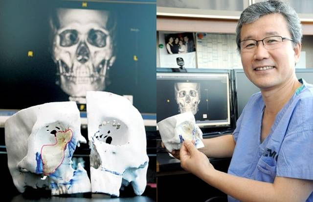 국내 처음으로 외과 수술에 활용된 3D프린팅 모형(왼쪽)과 수술을 집전한 백정환 삼성서울병원 이비인후과 교수. 