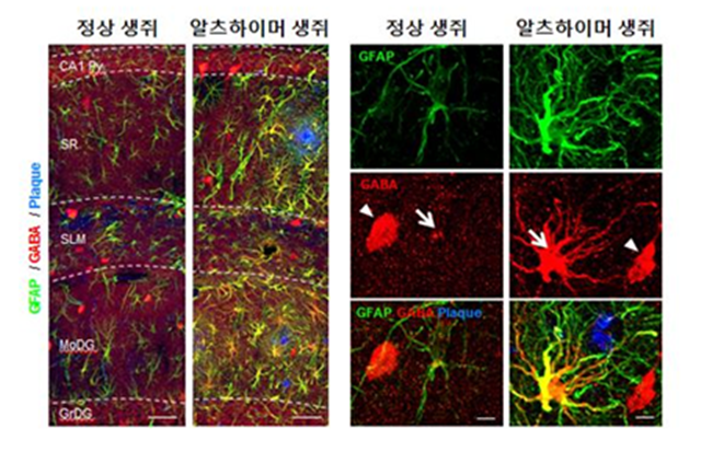 정상생쥐와 알츠하이머 생쥐의 뇌의 해마 부분에서 성상교세포 (초록)와 가바(빨강)를 면역염색 후 현미경으로 관찰. 가바가 신경세포전달을 억제하는 것으로 밝혀졌다. <사진= 미래창조과학부 제공> 