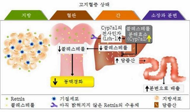 동맥경화의 원인과 동맥경화의 예방 및 관리법