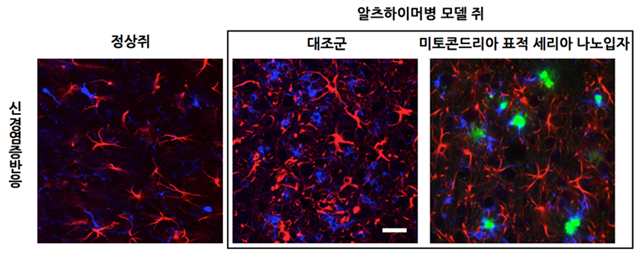 알츠하이머병 모델 생쥐의 뇌에서는 성상세포(붉은색)와 소교세포(파란색)가 늘어나 신경염증반응이 증가한다. 하지만 미토콘드리아 표적 산화세륨 나노입자(초록색)를 뇌에 주입한 경우 신경염증반응이 감소된 것을 알 수 있다. <사진=연구팀 제공> 
