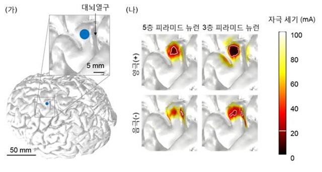 전성찬 교수 연구팀은 개발된 시뮬레이션을 통해 피라미드 형태의 뉴런 모델이 활성화 되는 영역을 해부학적 뇌 구조에 비추어 제시했다.<사진=GIST 제공>