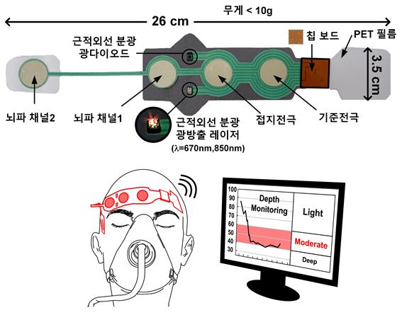 사용자 이마에 붙여서 사용하는 센서구성도. 뇌파 측정을 위해 4개의 전극을 사용한다. 뇌파 채널2는 왼쪽 눈 옆에 부착하고 나머지 기준전극, 접지전극, 뇌파 채널1 전극은 이마에 부착한다. 무게는 10g 이하로 가볍고 중앙에 근적외선 분광 측정용 모듈이 부착되어 있다. 혈 중 헤모글로빈 농도도 동시에 측정이 가능하다. 칩보드에서 신호 측정과 전송을 수행하며 코인 배터리가 포함되어 있다.<사진=연구팀 제공>