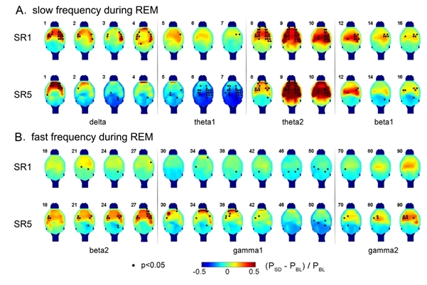 느린 주파수와 빠른 주파수의 진폭변화를 그린 뇌파 맵.<사진=KIST 제공>