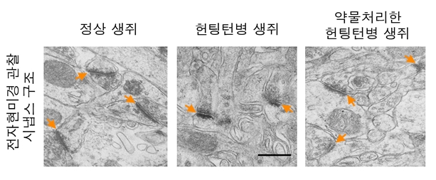 위축되어있는 헌팅턴병 생쥐의 선조체 신경세포의 시냅스 구조 (주황색 화살표) . 약물(nogalamycin)을 투여한 결과 시냅스의 구조가 회복되고 있음을 보여주고 있다.<사진=KIST 제공>
