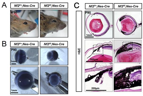 Nf2 유전자 결핍 생쥐의 안구 발달 이상.<사진=한국연구재단 제공>