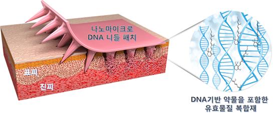 나노마이크로 DNA 니들패치의 DNA와 약물을 포함한 유효물질 체내 전달 원리.<사진=과학기술정보통신부 제공>