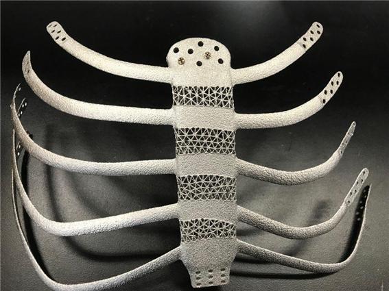 3D프린팅으로 제작된 순수 티타늄 소재 인공 흉곽 사진.<사진=한국생산기술연구원 제공>