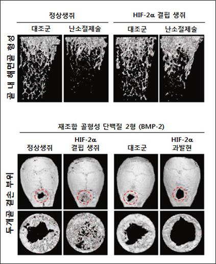 (위)난소절제로 골다공증이 유발된 생쥐의 대퇴골 속 해면골 형성을 분석한 사진. HIF-2α가 결핍된 골다공증 생쥐의 조골세포가 증가해 골형성이 촉진되고, 파골세포가 감소해 골소실이 회복됐다. (아래)생쥐 두개골에 원형 결손부를 만들고 골형성단백질(BMP-2)을 처리해 골재생 효과를 관찰한 사진. HIF-2α가 결핍된 생쥐는 골 형성이 촉진됐다. 반대로 HIF-2α가 과발현된 생쥐는 골재생이 지연됐다. <사진=연구재단 제공>