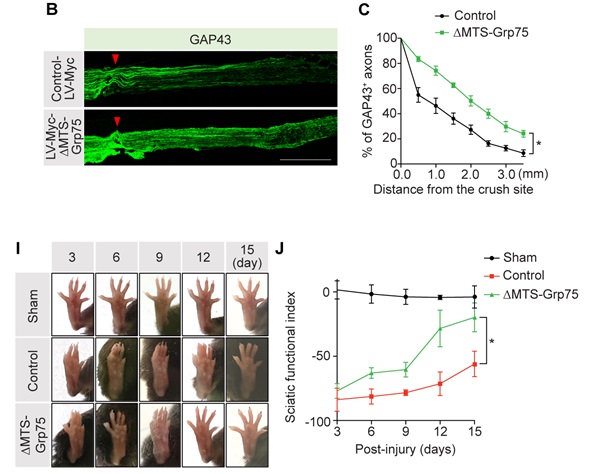 Grp75 유전자의 과발현으로 좌골신경이 손상된 실험 쥐의 신경이 재생되는 모습. 그림 B에서 신경세포는 형광녹색으로 보이는데, Grp75가 과발현된 아래쪽 그림에서 신경세포가 잘 재생됨을 알 수 있다. 그림 I와 J는 정상적인 신경세포(sham), 손상된 신경세포(contol), 손상됐지만 Grp75를 과발현한 신경세포(△MTS-Grp75)에서 시간에 따른 신경세포의 상태를 보여준다. Grp75가 과발현된 경우 보름 만에 정상 신경세포와 비슷한 모습으로 되살아났다. <그림=UNIST 제공>