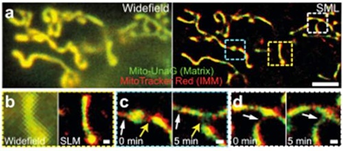 IBS 심상희 박사 연구팀이 민물장어의 형광단백질로 살아있는 세포내 구조를 8배 더 오래 관찰할 수 있는 초고해상도 형광현미경법을 개발했다. 사진은 살아있는 세포 내 미토콘드리아의 2색 초고해상도 동영상.<사진= IBS>
