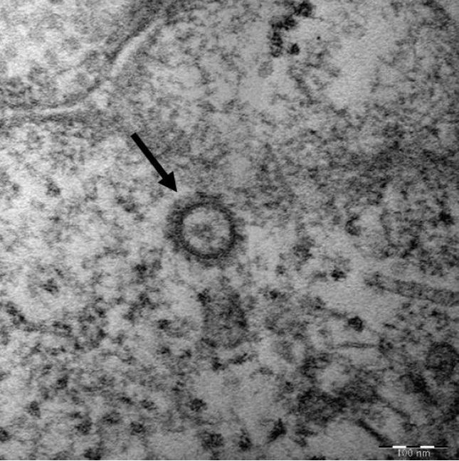 질병관리본부는 전자현미경으로 100나노미터 스케일로 관측한 코로나19 모습을 발표했다. <사진=질병관리본부 제공>