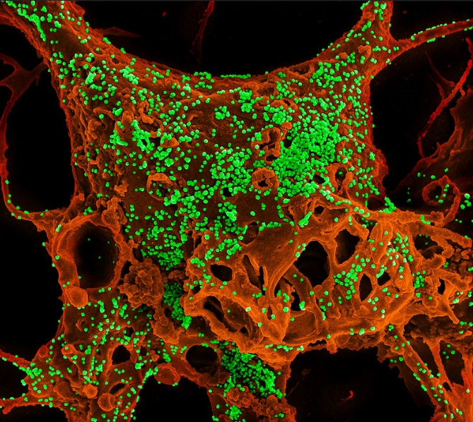 사스 코로나바이러스 입자(초록색)에 심하게 감염된 베로 E6 세포(주황색)의 전자 현미경 컬러 사진. <사진=NIH 홈페이지 갈무리>