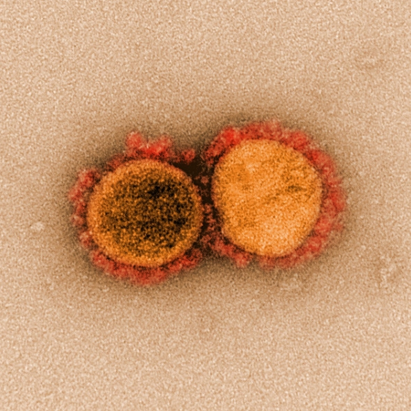 전자 현미경으로 관측한 코로나바이러스. <사진=NIH 홈페이지 갈무리>