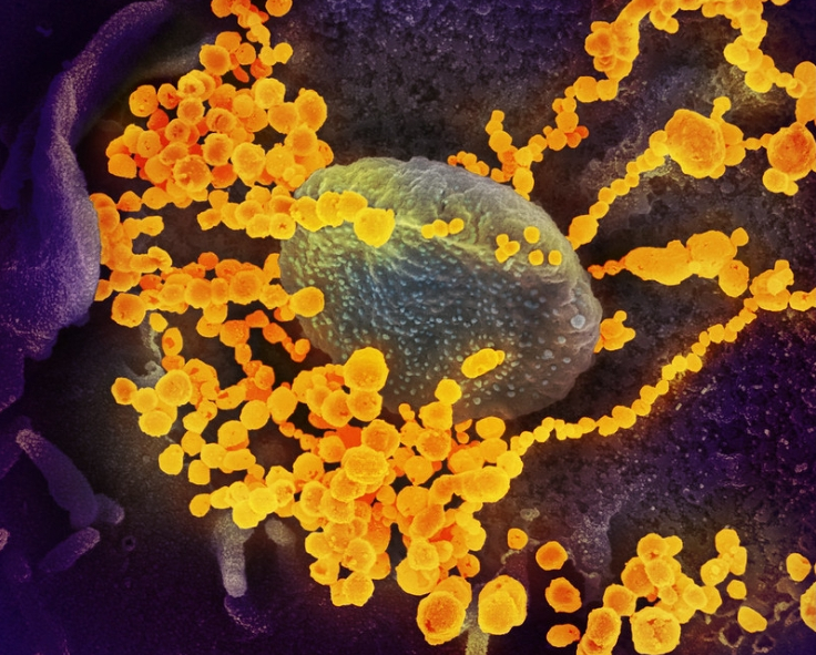 연구실에서 배양된 세포 표면에서 사스 코로나바이러스(원형 금색 물체)가 나오는 모습. <사진=NIH 홈페이지 갈무리>