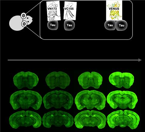 KIST 치매DTC융합연구단이 치매 유발 원인으로 알려진 타우 단백질을 응집초기부터 관찰할 수 있는 동물모델을 개발했다. 타우-BiFC 생쥐모델의 뇌에서 노화에 따른 타우 응집 정도 모니터링.<사진= KIST>