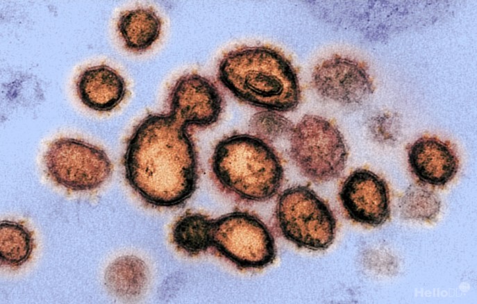 코로나바이러스감염증-19(코로나19)를 미국 국립보건원(NIH)에서 전자현미경으로 관측한 모습. <사진=NIH>