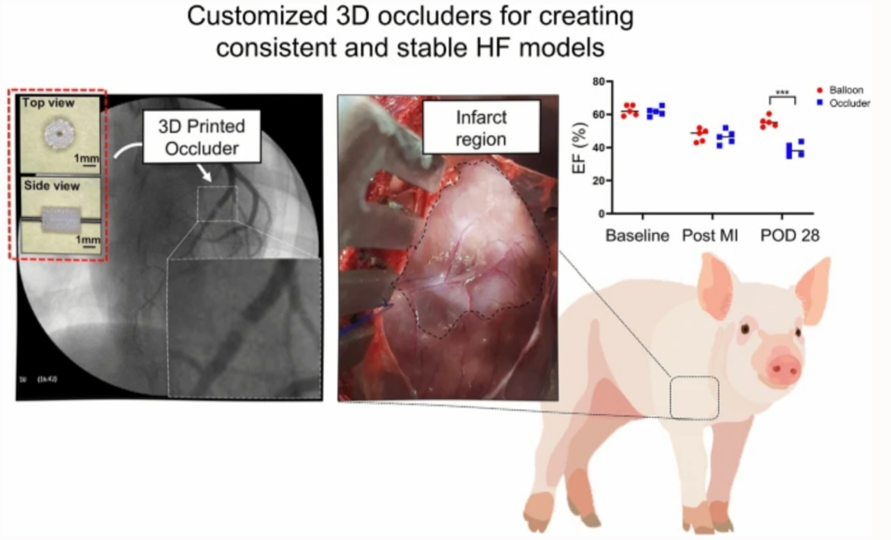 돼지 심근경색 모델 제작용 맞춤형 3D 프린팅 폐색기. [사진=POSTECH 제공]