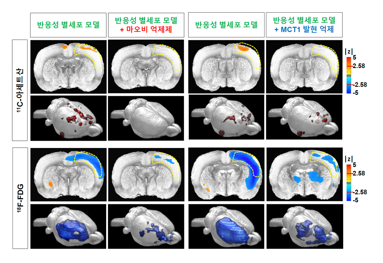 KIST 유일 신경과학 연구 한의사···뇌질환 정복 꿈꾸다